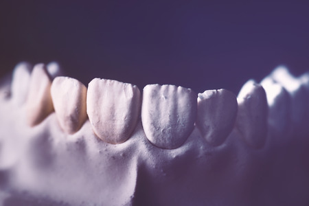 Dental prosthesis, artificial tooth. Photo of artificial teeth made in the dental laboratory.の写真素材