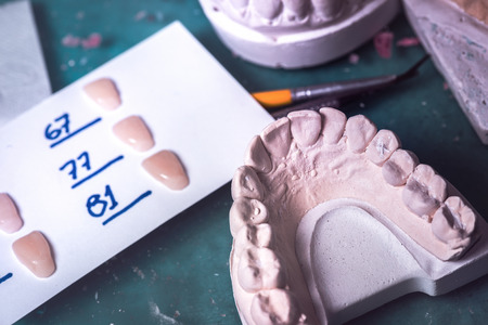 Dental prosthesis, artificial tooth. Photo of artificial teeth made in the dental laboratory.