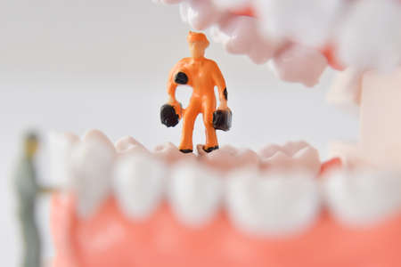 Close-up of miniature people worker cleaning tooth model as medical and healthcare. Idea for cleaning dental care or dentist.のeditorial素材