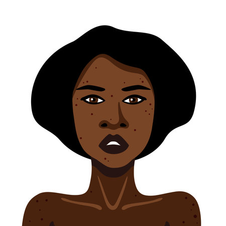 Young African American woman with acne on her body on white background vector illustration inのイラスト素材