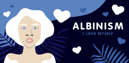 Banner about albinism with young beautiful African American woman minimalistic illustrationのイラスト素材