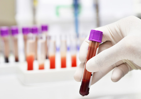 blood tube in hand blood tube in hand