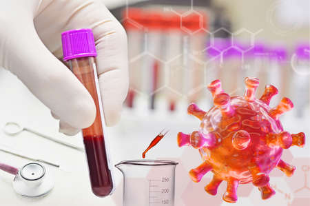covid-19 virus. scientist testing of human blood in laboratory for diagnosis coronavirus.