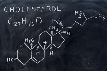 Molecular and structural formula of cholesterol written on a blackboardの写真素材