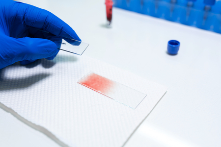 scientist prepare blood sample for research on microscope. Placing blood sample on microscope slide. Science and medicine concept.の写真素材
