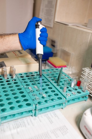 laboratory assistant analyzing a blood sample using micropipette.の写真素材