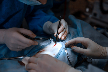 Closeup surgeon hands in bit bloody white gloves make operation.