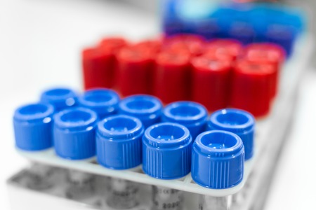 Closeup set of sterile vacuum test-tubes for blood sample.の写真素材