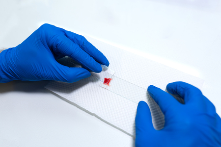 scientist prepare blood sample for research on microscope. Placing blood sample on microscope slide. Science and medicine concept.の写真素材