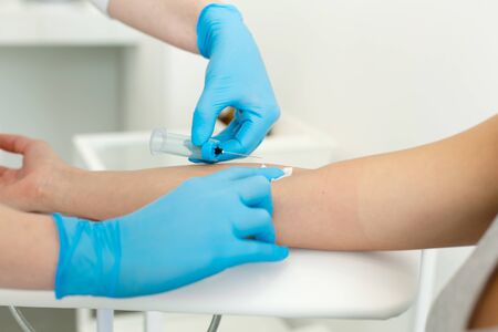 a nurse in the clinic inserts a catheter into a vein for blood testing for a young girl.の写真素材