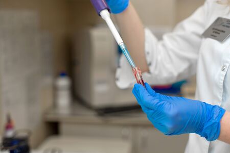 Woman lab technician take blood sample from test tube.