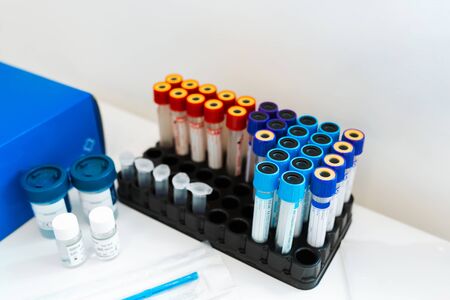 set of blood test tubes on a bright laboratory table.の写真素材
