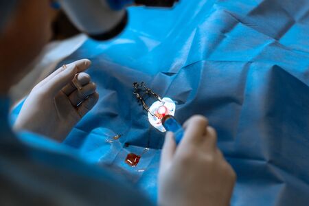 pet ophthalmologist surgeon doing difficult operation on injured dog eyeの写真素材