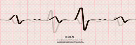 Cardiology concept with pulse rate diagram. Medical background with heart cardiogramのイラスト素材