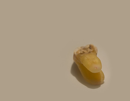 tooth with dental caries ,Maintaining oral health. (with free space for text)の写真素材