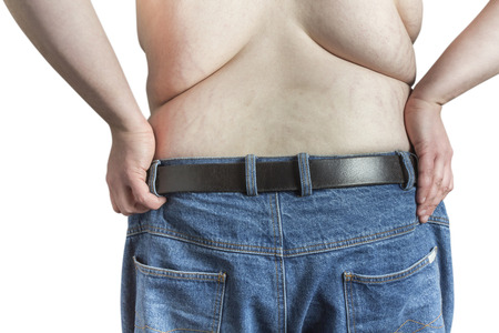 Back of a shirtless overweight Man