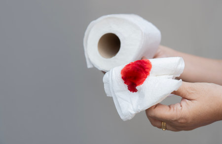 Cropped shot of woman hands holds toilet paper with blood, hemorrhoids,  gray background. Selective focus, copy space.の写真素材