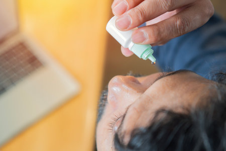 An office worker puts drops in his eyes to relieve pain from long hours of work at a computer and laptop. Top view, close-up.の写真素材