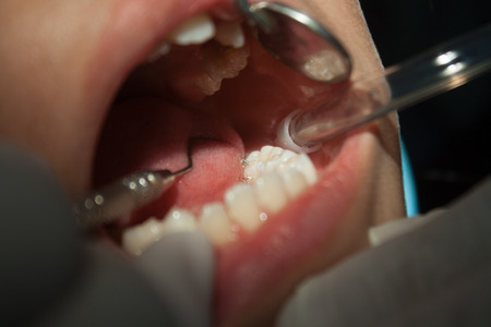 Dental, Dental examination and treatment of children.の写真素材