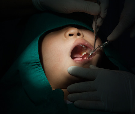 Still Life-Dentist holding mirror dental treatment, dental sealants.の写真素材