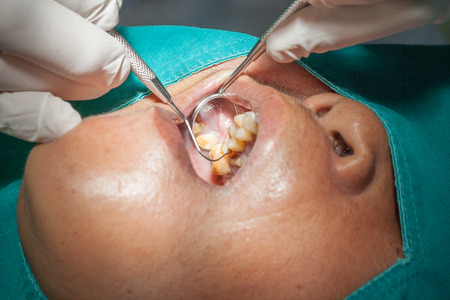 Dental, dentist using dental instruments. Treatment the teeth in dental health problems.