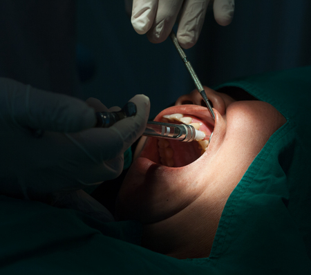 Dentists, dentists are injecting into the patient's mouth. Close Up.の写真素材