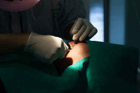 Dentists are extracting patients teeth.の写真素材