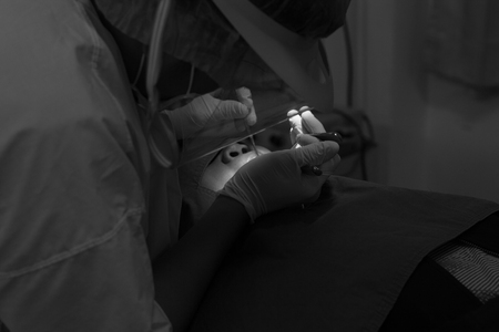 Dentists are extracting teeth. Black and whiteの写真素材