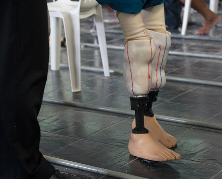 Disabled legs, walking with prostheticsの写真素材