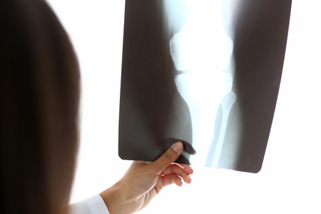 Female black doctor hold in arm and lookの写真素材