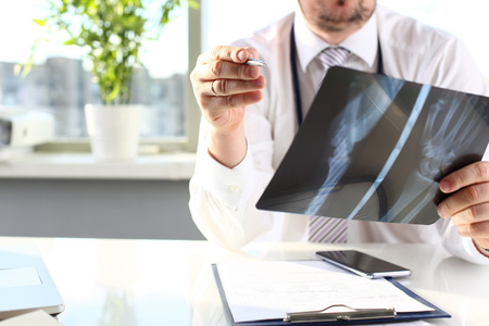 Male doctor hold in arm silver pen and look at xrayの写真素材