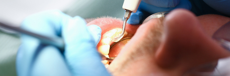 Female hand in blue protective glovesの写真素材