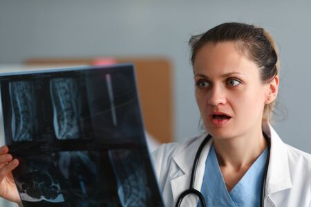 Excited woman doctor hold x-ray film in hand againt clinic office background. Rare disease concept