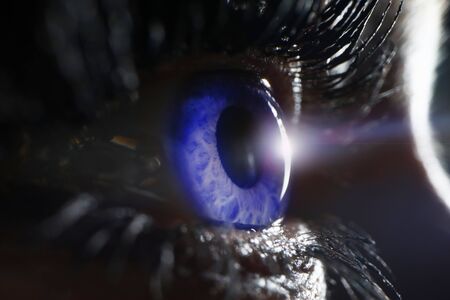 Laser vision correction concept. Blue female eye on surgery clinic exam closeup. Treatment for astegmatism and myopiaの写真素材
