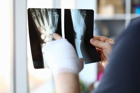 Male bandaged hand holds xray image closeup. Injury and sprain treatment concept