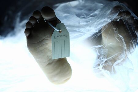 Male leg with tag lies on table in morgue. Chinese corona virus fear concept