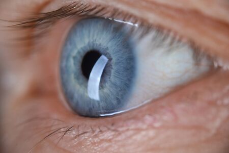 Male eye blu color super macro closeup shot. Laser vision correction and cataract treatment conceptの写真素材
