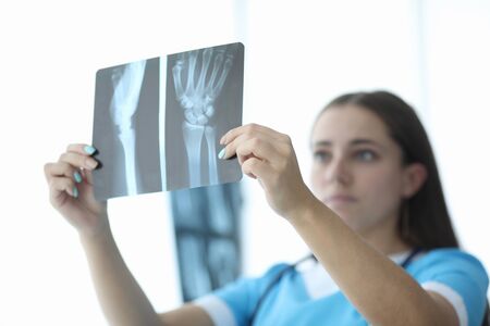 Close-up of female hands holding skiagram. Serious surgeon looking attentively on wrist x-ray and making diagnosis. Traumatology and health care conceptの写真素材