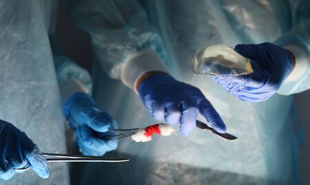 Surgeon holds breast implant next to assistant. Doctors doing an operation. Hands instruments for surgery and cotton swab in blood. Close-up professional uniform and assistant at workの写真素材