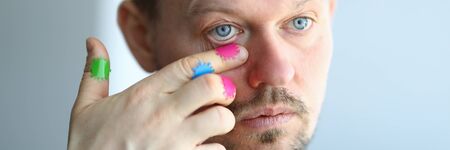 Man scratches his face with a dirty hand near his eye portrait. Virus infection conceptの写真素材