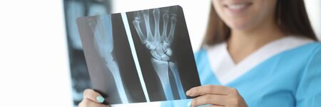 Close-up of female hands holding wrist skiagram. Smiling doctor traumatologist examining...