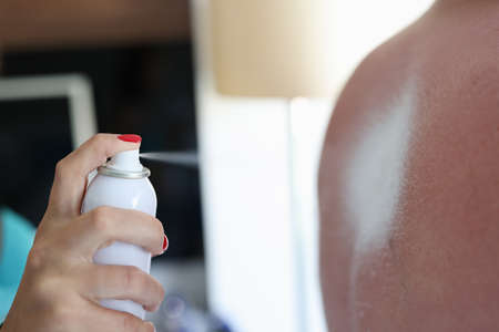 Female hand hold white spray with cream close-up. Woman treat tanning male back for hydration.
