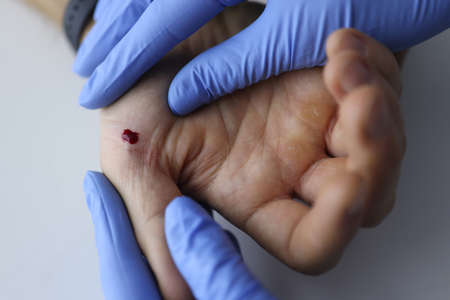 Doctor in gloves holds the patients hand with blood. Medical assistance and taking tests conceptの写真素材