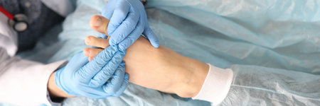Dermatologist is holding foot of woman with damaged thumb in his hands in rubber gloves in clinic. Treatment of fungal nail infections concept.の写真素材