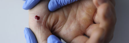 Doctor in gloves holds the patients hand with blood. Medical assistance and taking tests conceptの写真素材