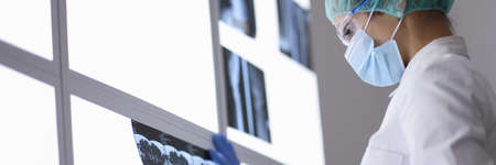 Doctor in protective medical mask and gloves examines an X-ray. Infection and disease in the 21st century conceptの写真素材