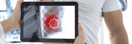 Man underwent x-ray examination which showed pneumonia. X-ray examination during epidemic of...