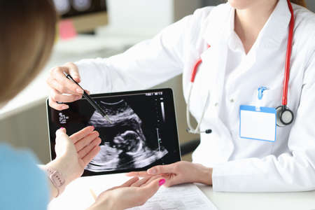Doctor showing patient woman ultrasound scan of fetus on digital tablet closeupの写真素材