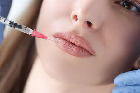 Portrait of woman whose lips are injected by beauticianの写真素材