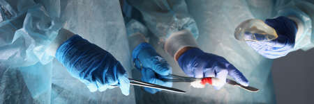 Doctors surgeons in protective coats holding instruments and breast implant in operating room closeupの写真素材